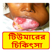 টিউমার রোগের চিকিৎসা ~ Tumor Treatment Apk