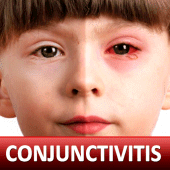 Conjunctivitis & Pinkeye Help Apk