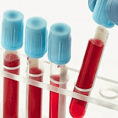 Blood Test Results Apk