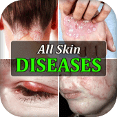 All Skin Diseases & Treatment Apk