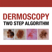 Dermoscopy Two Step Algorithm Apk